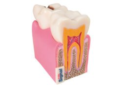 Tooth 3D anatomic model