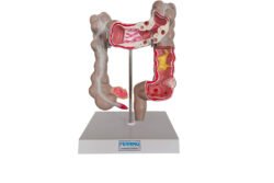3D Large intestine model