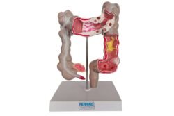 Modelo anatómico del colon