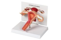 Modelo anatómico del úteroovario femenino